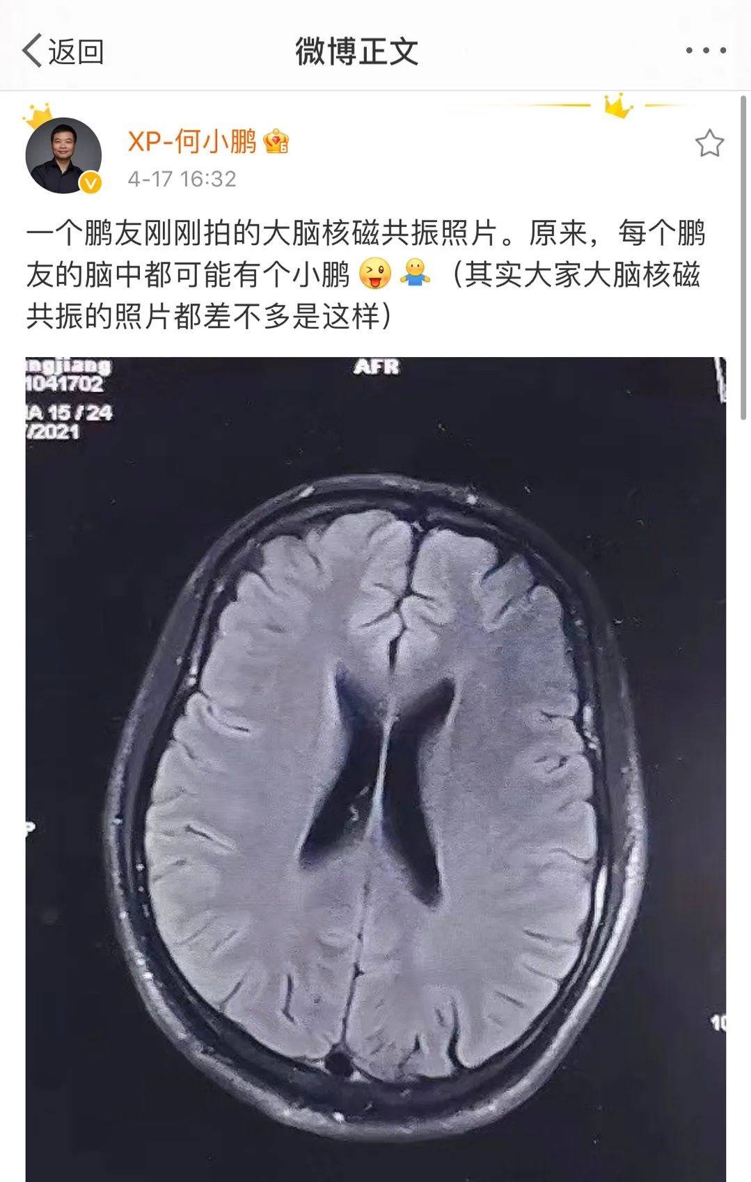最强大脑歌手选手_最强大脑水哥个人资料_最强大脑第二季水哥视频