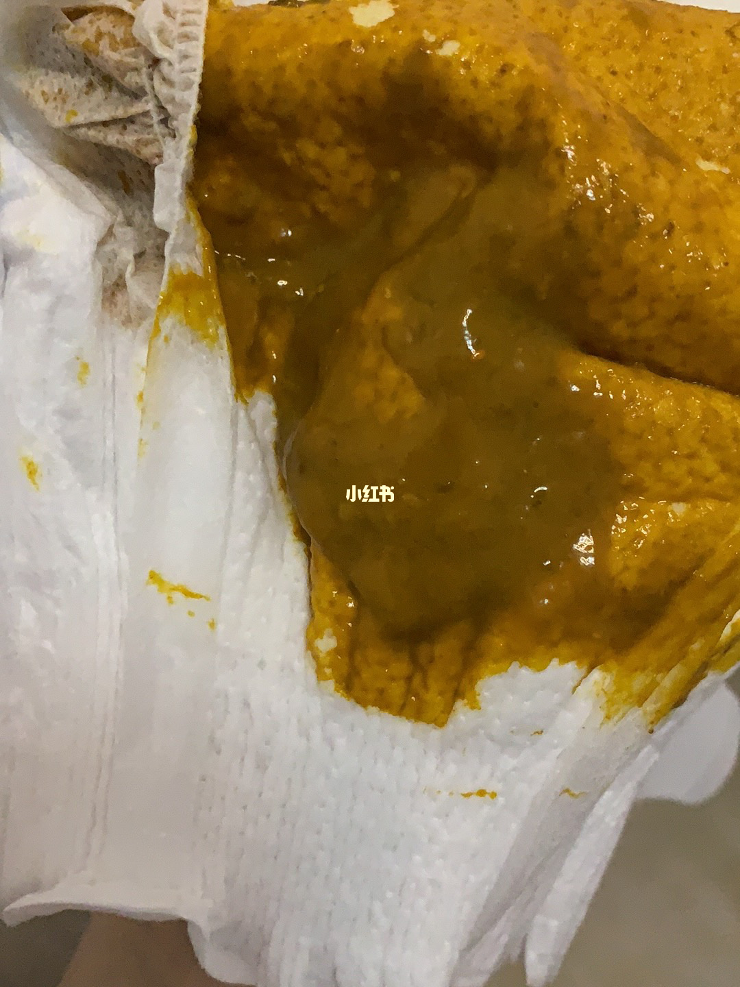 拉肚子百度宝宝知道_肚子里宝宝拉粑粑吗_肚子里的宝宝拉的屎去哪了