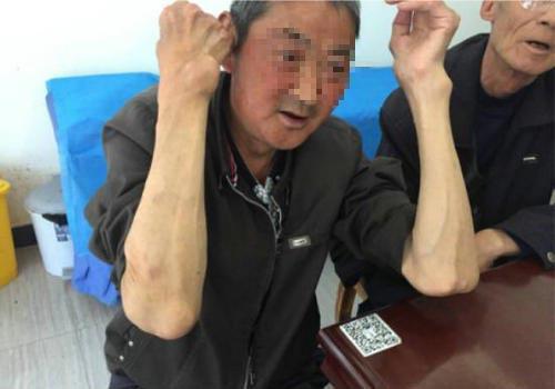 打电脑游戏左手手机僵硬_玩电脑左手发麻_左手僵硬电脑打手机游戏会好吗